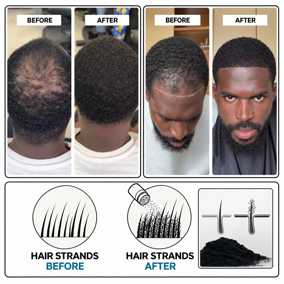 Fuller Hair Instantly Kit